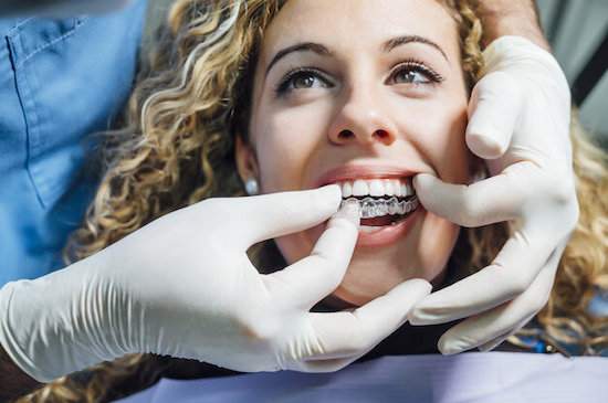 teeth alignment or orthodontic issues